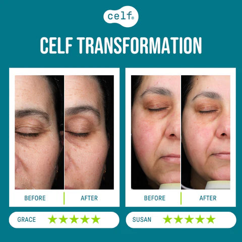CELF Microvibration Therapy – anti-ageing skincare tool and hyaluronic acid serum for firmer, radiant skin