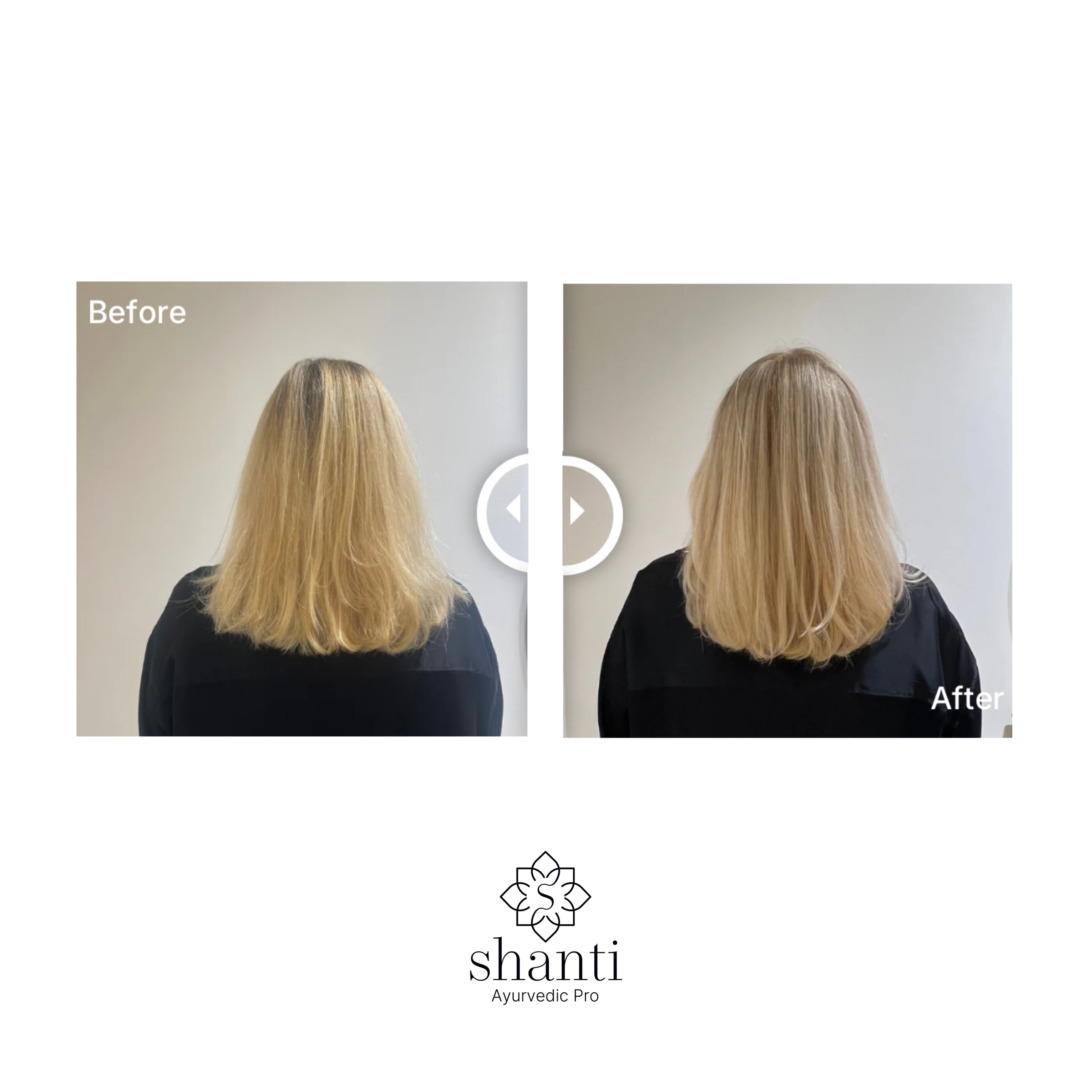 Shanti Miracle Hair Oil bottle – lightweight hair oil for dry, frizzy, or damaged hair