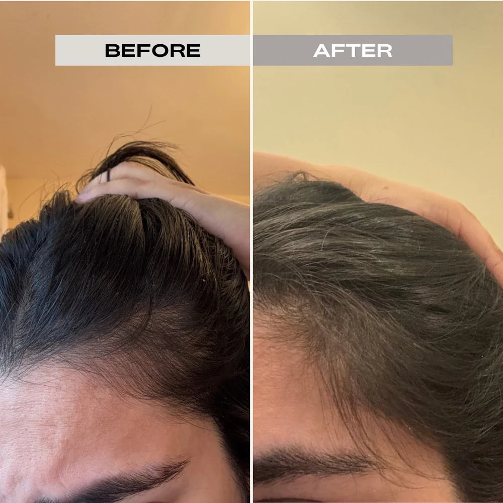 PERL Stimulating Hair Oil – natural scalp treatment for growth and strength