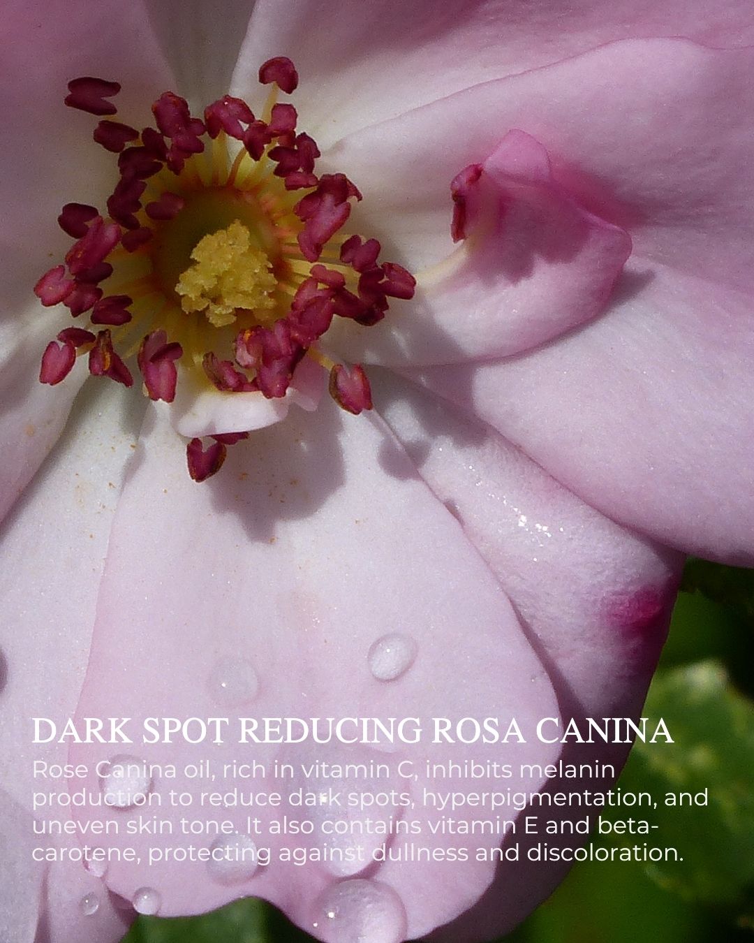 Bright Complexion Radiance Serum – dark spot reducing, brightening Vitamin C serum