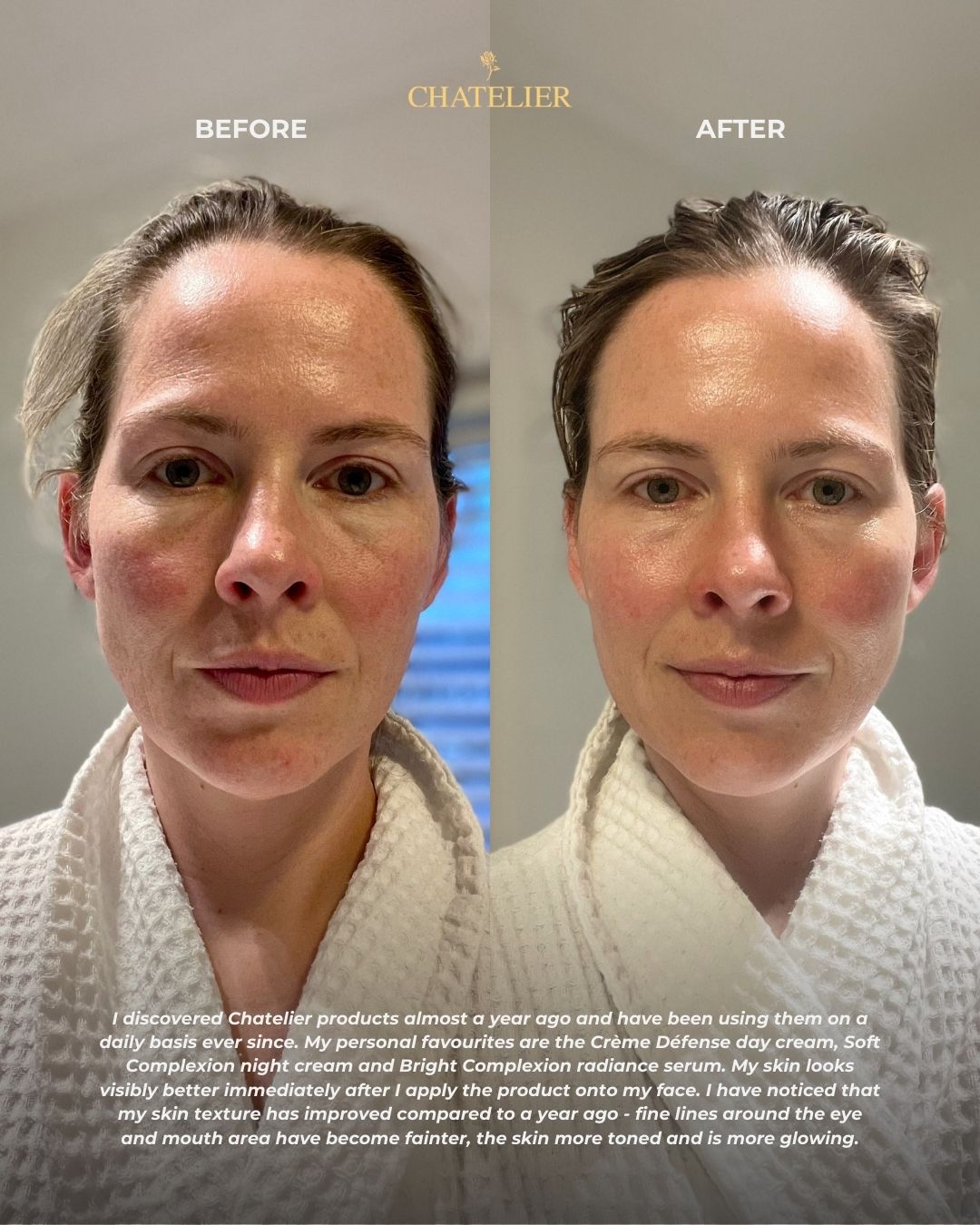 CRÈME DÉFENSE™ Age Protective Day Cream with UV-A protection, anti-aging and brightening skincare