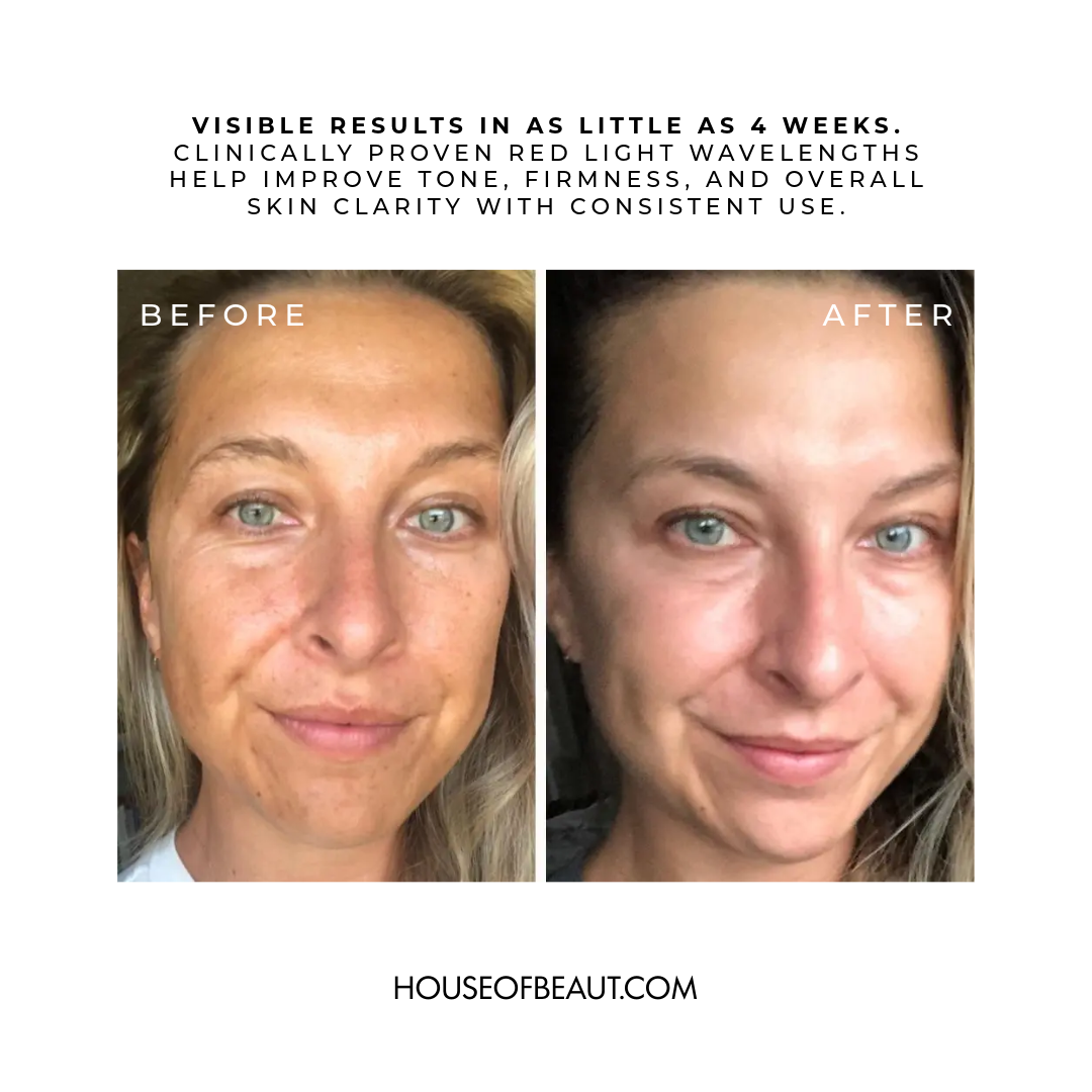 The Beaut™ Red Light Therapy Mask for Face + Neck